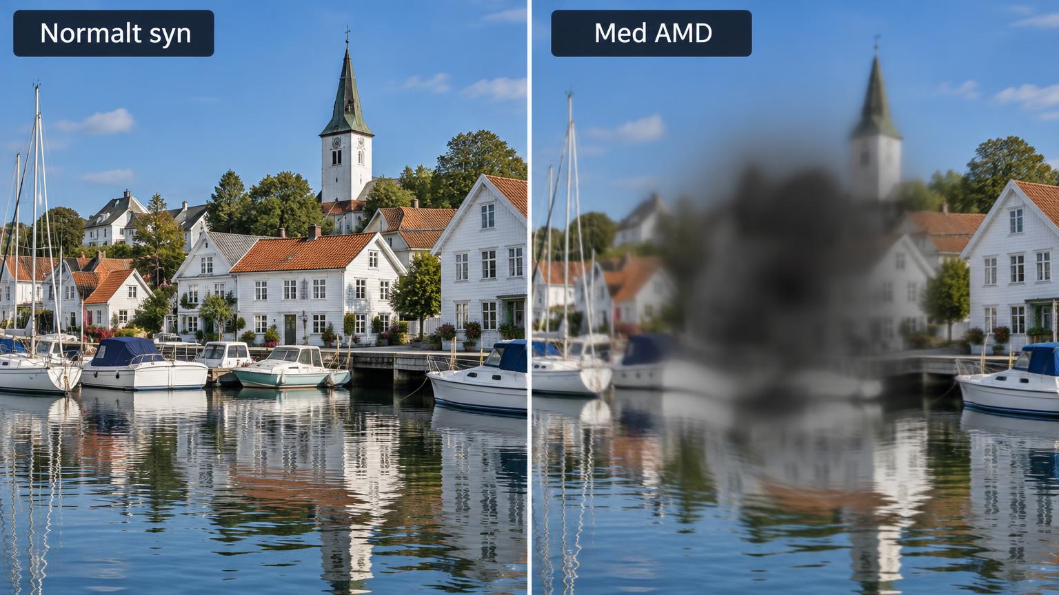 Samme havnebilde sett med normalt syn og med AMD, der midten av bildet er uklart og mørkt